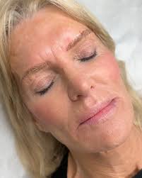 loved this transformation 😮‍💨 She was so excited and happy to not have  her lips blend in , anymore! She had to get her lips to match her fresh  microbladed brows! Now she is ready for summer and to ...