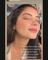 Andres Tobar Padilla MD (@dr_andrestobar) • Instagram photos and videos