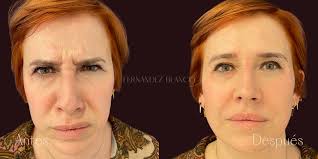 Dr. Andrea De La Puente : Aesthetic Medicine : FB Clinic