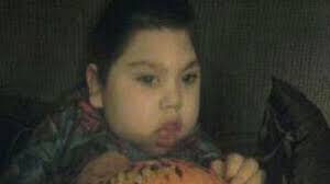 Colo. child born without brain dies after 3 years of defying odds