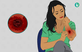 Nonmelanoma skin cancer is usually curable. Skin Cancer Melanoma Symptoms Causes Treatment Medicine Prevention Diagnosis