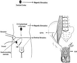 Image result for Cremasteric Reflex