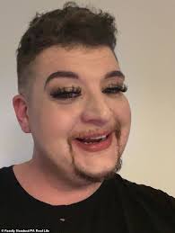 I knew I was different to other children growing up and began self harming  at eight years old. Then a rare diagnosis explained everything