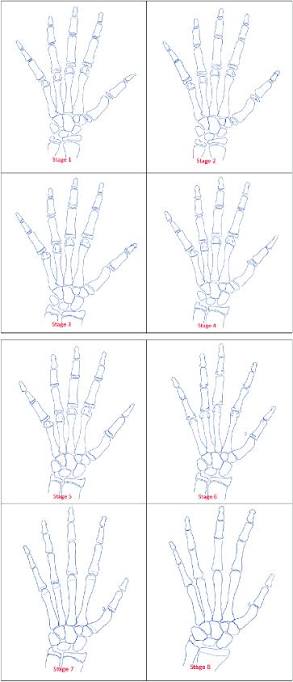 Sanders's skeletal maturity staging system. ما هو تصنيف ساندرز (Sanders Staging)؟