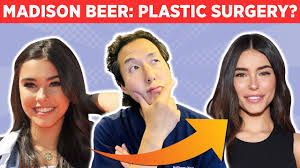 Sep 16, 2020 · three new hyaluronic acid fillers have entered the us market. Did Madison Beer Have Cosmetic Surgery One Plastic Surgeon S Reaction Dr Anthony Youn Youtube