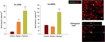 Repeated paced mating promotes the arrival of more newborn neurons in the  main and accessory olfactory bulbs of adult female rats