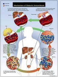 Mechanism Of Diabetic Ketoacidosis Diabetic Ketoacidosis Diabetes Education Nurse