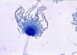 That means this species tends to induce a hypersensitive (allergic) reaction instead of infecting the body. Aspergillus Flavus Aspergillus Aspergillosis Website