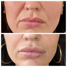 Rita Medical Elite, 3847 S School Ave, Sarasota, FL 34239, US