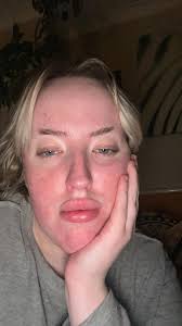 3 months yesterday clean from alcohol, can't wait for the next 3 months and  forward. Keep going everyone, no matter what you're sober from just keep  going. Distract yourself is my biggest