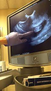 fakegram barriga de gravidez fotos da barriga de gravidez fotos de barriga