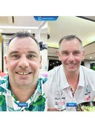 Dental Bridges in Hà Noi, Vietnam • Check Prices & Reviews