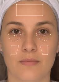 Coloration in different areas of facial skin is a cue to health: The role  of cheek redness and periorbital luminance in health perception