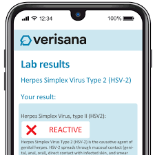 Image result for Herpes Simplex Virus Testing