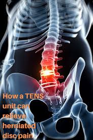 Pin On All About Tens Unit Therapy