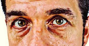 Home Remedies For Wrinkles Under Eyes Under Eye Wrinkles Home Remedies For Wrinkles Homemade Wrinkle Cream