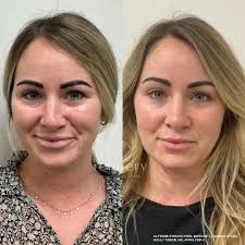 Holly Tabor, MS, APRN, FNP-C