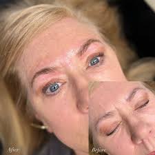 Hannah Sumner, L.E. (@estheticsbyhann_) • Instagram photos and videos