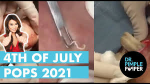 Very very thank you everyone new videos are updated every day. Dr Pimple Popper S 4th Of July Pops Fireworks Spectacular 2021 Youtube