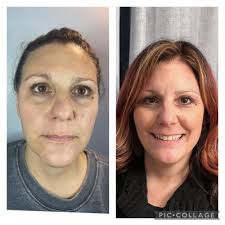 TOP 10 BEST Laser Skin Care near Orchard Park, NY