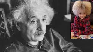Megdöbbentő! Ez a kislány ugyanabban a betegségben szenved, mint Einstein