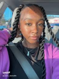 My face is getting clear 🙏🏽