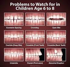 Problems To Watch For In Children Age 6 8 Tannhelse Tannlege Ideer
