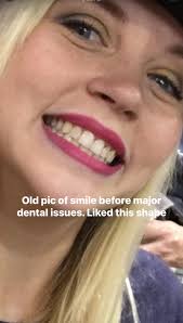 Had to swing by Fall Creek Dental today to see my favorite duo—the dentist  and her rockstar hygienist. Gotta keep this smile in top shape now that I  actually enjoy showing it