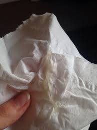 What does it look like when you lose your mucus plug. Mucus Plug Loss At 33 Weeks