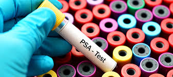 What does prostate cancer feel like? Prostate Cancer Screening Guidelines Puts Patient Choice First Fox Chase Cancer Center Philadelphia Pa