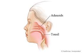 Image result for Adenodolichos