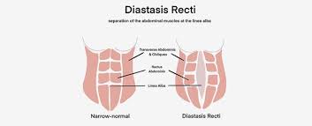 For example, chewing on the bottom lip may indicate that the. Pelvic Floor Strong Reviews Legit Program Or Fake