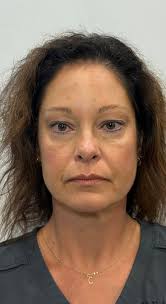 ✨Subtle Enhancements. Natural Results✨ Full Facial Balancing, using the  Juvederm Collection of Fillers, we're able to restore volume, soften lines,  and enhance facial proportions for a refreshed, natural look. This  treatment addresses