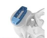 OLIF Titanium - GESCO Healthcare