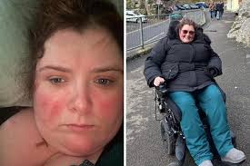 Woman with life-threatening disease 'trapped' in 'unsuitable' south Essex  flat