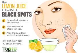 Onion juice has been proven to help remove skin scarring. Honey Remove Dark Spots On Face Novocom Top