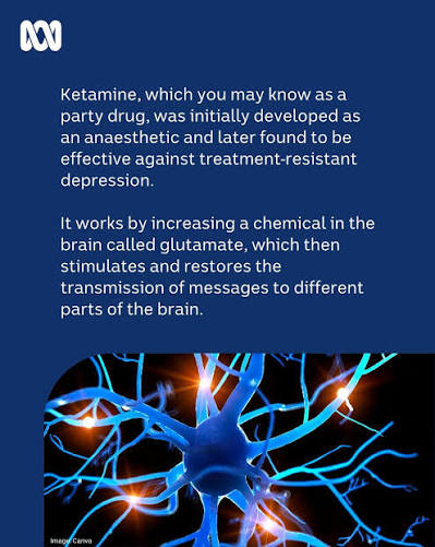 Ketamine can be an effective treatment for severe depression that hasn't responded to standard medications or therapies. One of the ketamine-based treatments available in Australia is about to become cheaper for thousands
