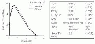 Image result for Diffusing Capacity