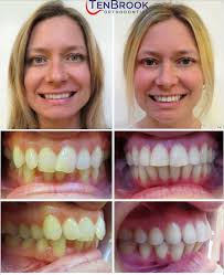 TenBrook Orthodontics (@tenbrookortho) • Instagram photos and videos