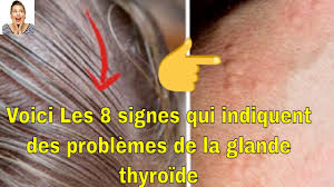 Maybe you would like to learn more about one of these? Hyperthyroidie Quelle Est La Thyroide Hyperactive Symptomes Et Causes Les Maladies 2021