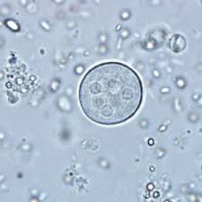 Dpdx Monthy Case Studies Case 291 Medical Lab Technician Medical Laboratory Science Medical Laboratory