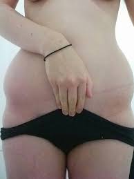 # hip dips are caused by three things: Does Anyone Else Have This Violin Hips Body Shape How Do You Dress Mumsnet