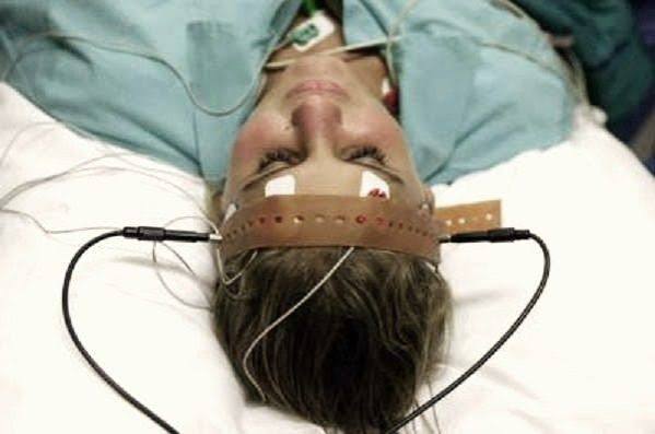Scientists Reveal How Electro-Shock Therapy May Treat Depression after More  than 70yrs