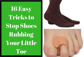 16 Easy Methods To Stop Your Shoes Rubbing Your Pinky Toe Or Little Toe Little Toes Pinky Toe Toe Blister