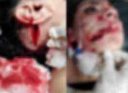 إسراء عماد تكشف تفاصيل تنازلها عن القضية ضد زوجها. Ø¨Ø¹Ø¯ Ø£Ù† Ø·Ø¹Ù†Ù‡Ø§ ÙˆØ´ÙˆÙ‡ ÙˆØ¬Ù‡Ù‡Ø§ Ø¥Ø³Ø±Ø§Ø¡ Ø¹Ù…Ø§Ø¯ ØªØ¹ÙÙˆ Ø¹Ù† Ø²ÙˆØ¬Ù‡Ø§ ÙˆØªØ¹ÙˆØ¯ Ù„Ù‡ Ø§Ù„Ø¨ÙˆØ§Ø¨Ø©