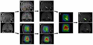 You cannot make wager matches, blind trading. Frontiers Automated Roi Based Labeling For Multi Voxel Magnetic Resonance Spectroscopy Data Using Freesurfer Molecular Neuroscience