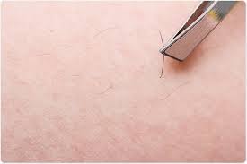 Rub your face in a circular motion every day using a wet washcloth or an exfoliating scrub to tease out ingrown hairs. Preventing Ingrown Hairs