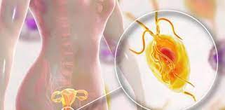Desde hace algunos años, una de las técnicas más utilizadas en el cine de ciencia ficción es el cgi. Trichomonas Vaginalis Que Es Sintomas Causas Y Como Tratar La Enfermedad