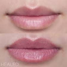 Healed Lip Blush Amazing Results After One Session Added Major Fullness By Tattooing Her Boarders Whi Lip Blushing Lip Blush Permanent Makeup Eyebrows
