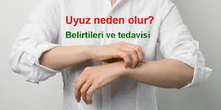 uyuz hastaligi nedir neden olur belirtileri ve tedavisi